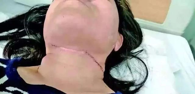 伤人割喉仅在一瞬间