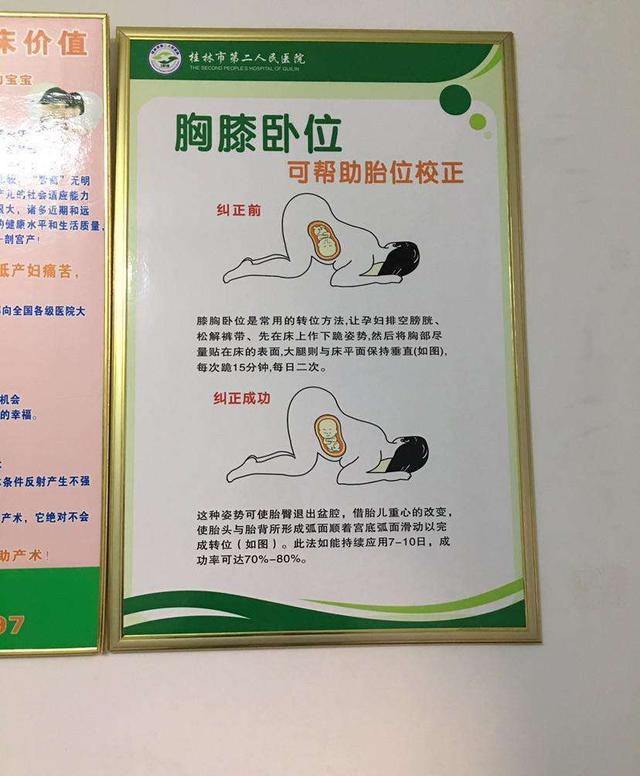 胎位不正?在这周之前纠正还可以,超过时间,再忙活也难转正