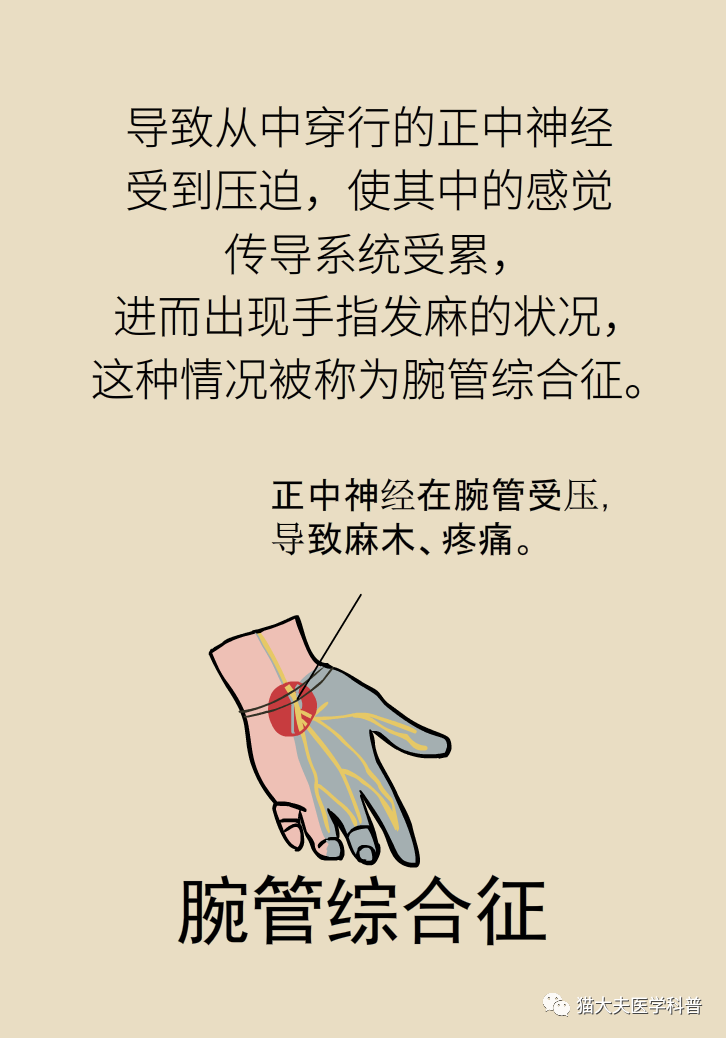 无缘无故的手麻?掐指一算,你可能是5种病上身了