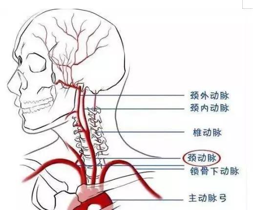 5分钟搞懂颈动脉斑块血管专家赵志青教授告诉你脑中风防治法