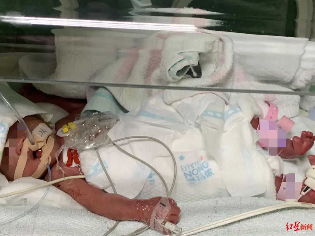 早产双胞胎姐妹出生仅2斤,父母这句话让人泪目