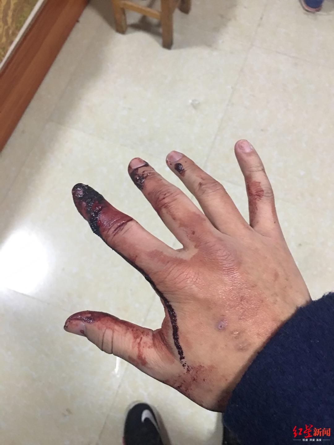 正文  有人揪住他的头发,有人挥拳,有人抬腿踢去,殴打过程持续约50秒.