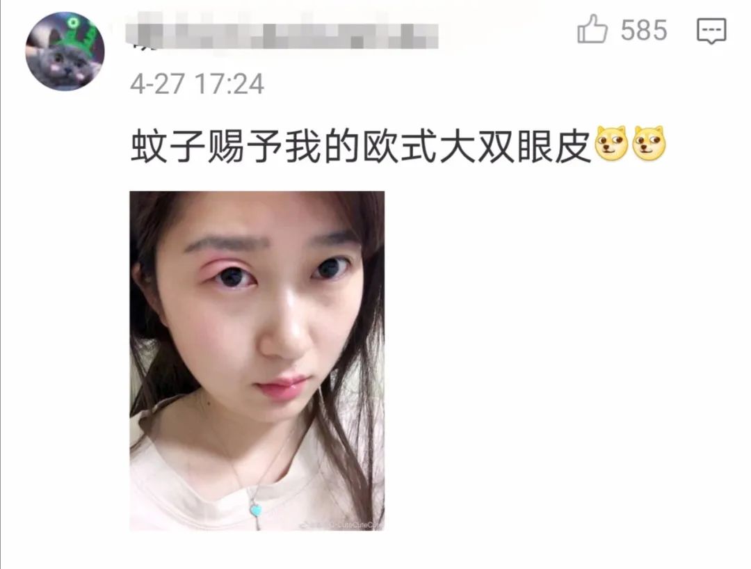 "你被蚊子咬过最无语的地方是哪里?"评论笑吐了!