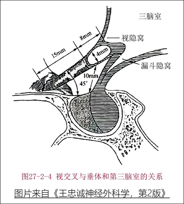 正常垂体的mri表现|解剖学|血管_新浪新闻