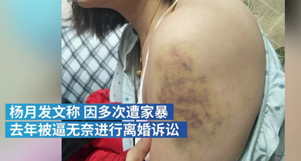 微博热搜第一视频曝光女子称遭家暴16年