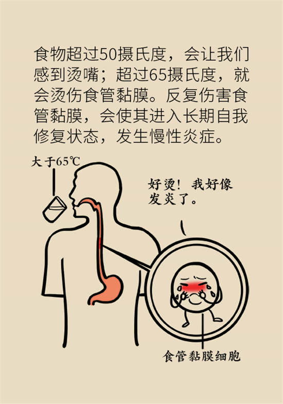 关于食管癌这些早期信号一定要注意