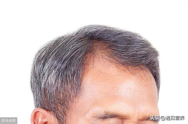 白发哪个染发最好的