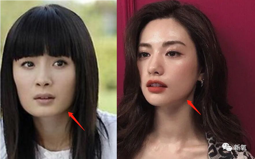 做了不下10项整形手术却从没脸崩过的亚洲第一美人服气