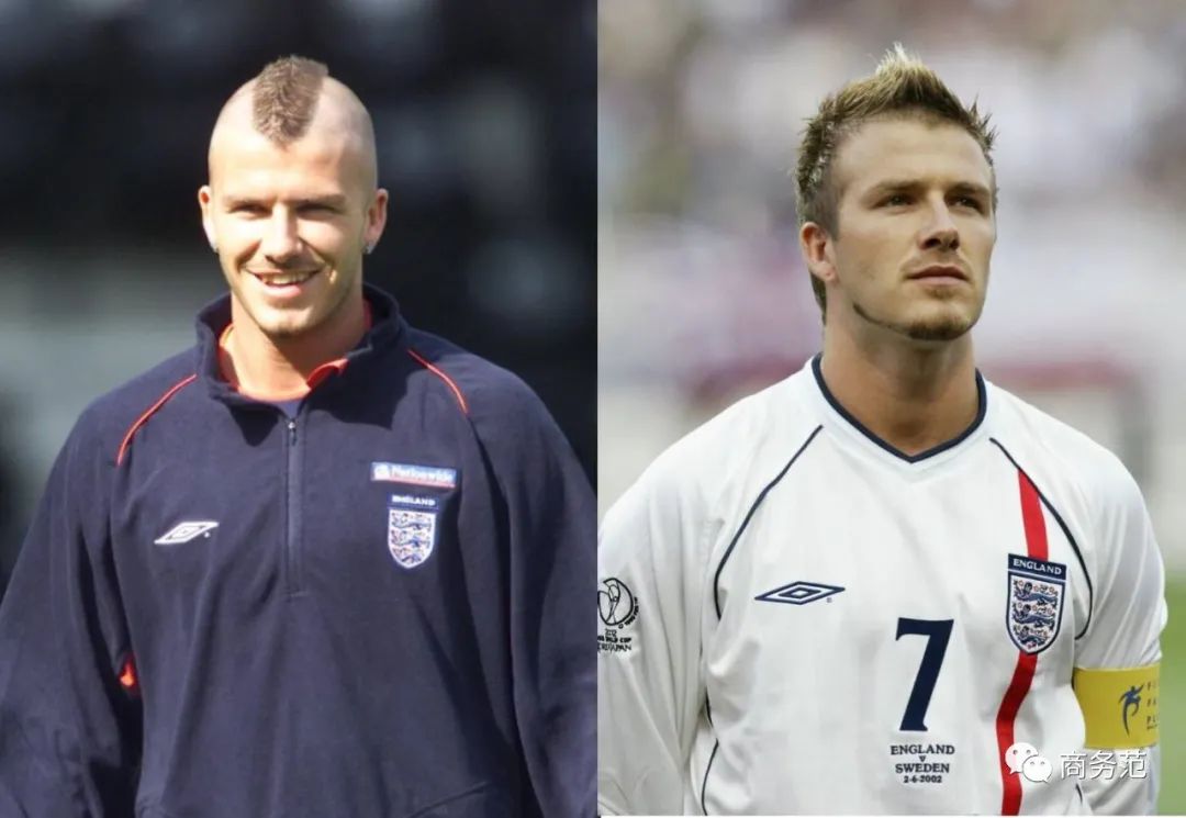 45岁贝克汉姆谢顶,威廉哈里集体脱发,英国男人为啥容易秃?__财经头条