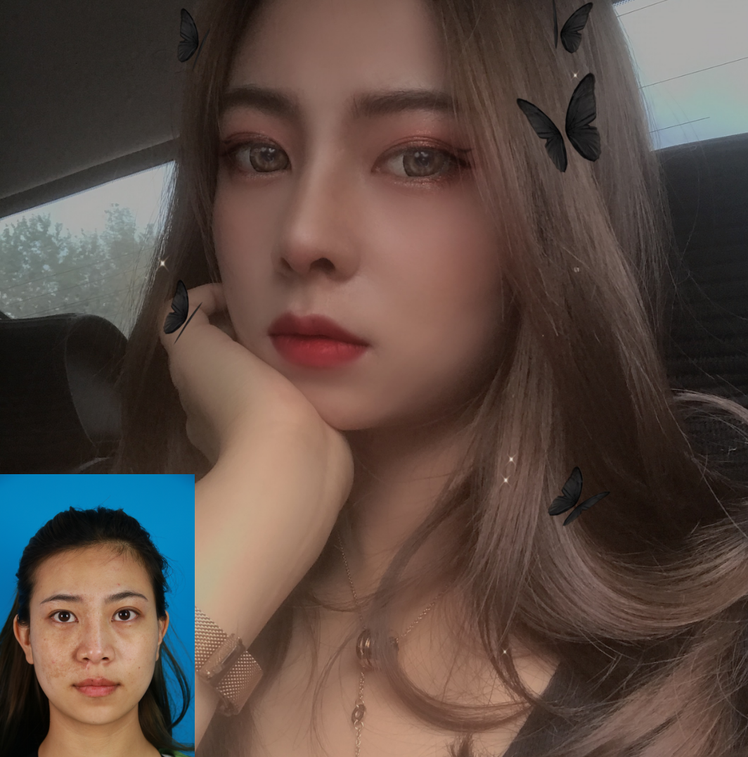 吴氏鼻子提醒你鼻子别瞎整5月16日第四届西南鼻整形高峰论坛暨吴氏鼻