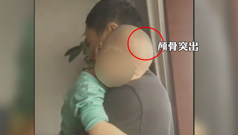 3岁宝宝竟成大头娃娃一个月花3000元喝了89罐假奶粉竟是固体饮料