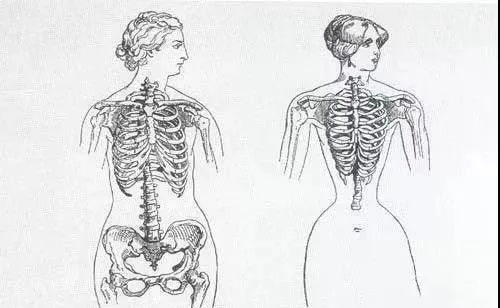 "内脏下垂,子宫脱落,漏尿……":扒一扒你不知道的网红束腰