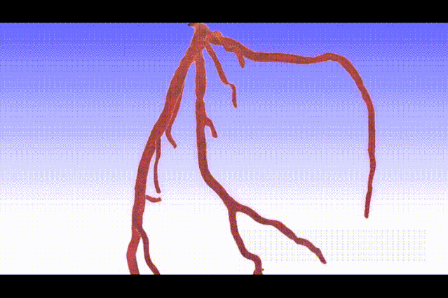 可以在不同尺度上精确地模拟通过患者特定主动脉和其他血管的血流情况