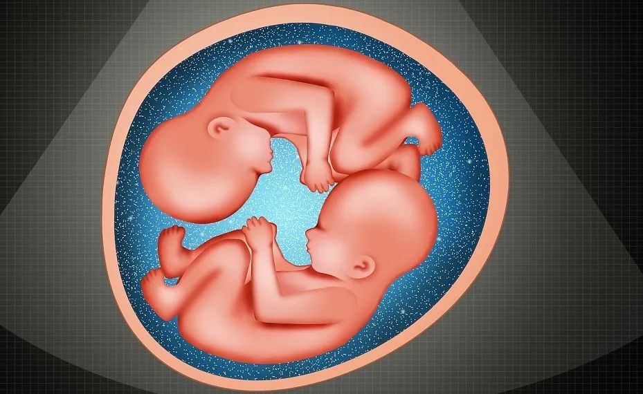 胎中女性的学历,婚育,收入都更低,因为受到其双胞胎兄弟的雄激素影响