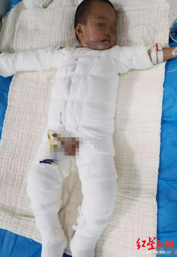 小雷目前仍处于病重观察阶段图据受访者