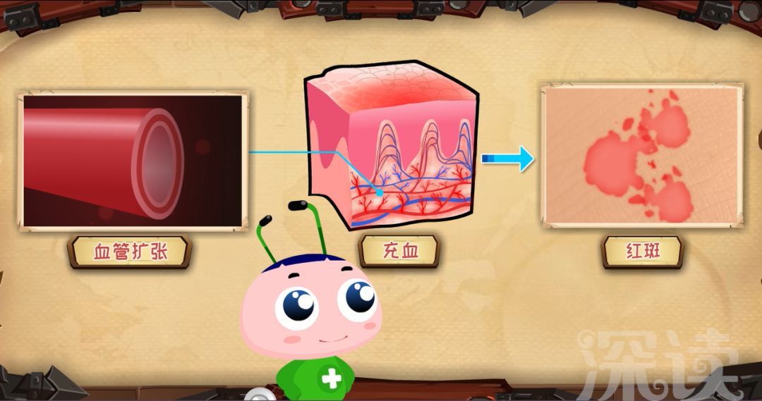 动漫版《银屑病》4集连播,最炫酷的硬核科普,过瘾!