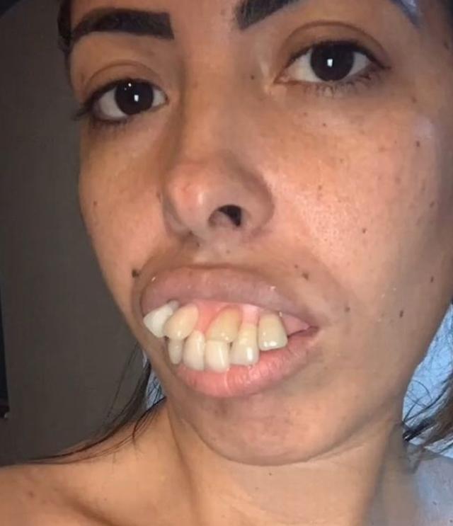 超丑的女照片龅牙的图片