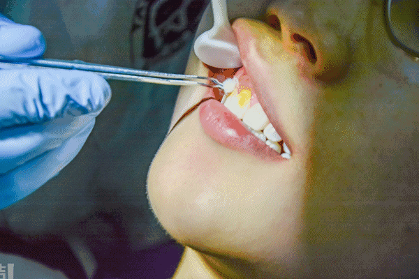 399秒杀雅尔口腔价值450元的洗牙套餐口碑爆棚还有儿童滑梯快来秒杀