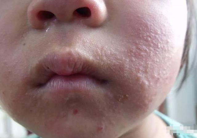 宝宝1岁前不能吃的3种水果,宝妈要记牢,对孩子身体没好处|过敏_新浪