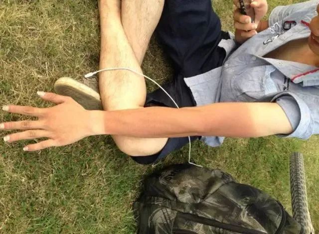 长此已久,都晒成"熊猫手"了但皮肤还是避免不了被晒黑虽说有大部分