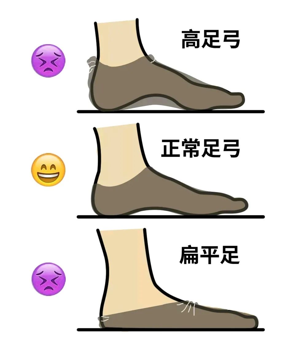 科学解决走路掉袜子,最后一招你绝对想不到|足弓|摩擦力|图片来源