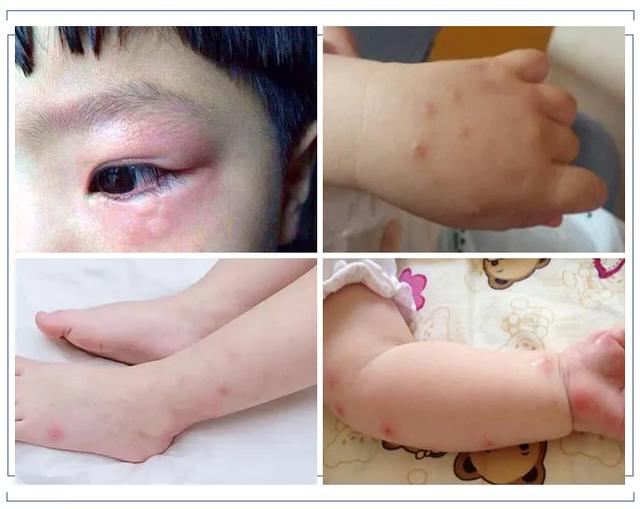 吴尊代言澳洲驱蚊神器,喷在手上,蚊子对你敬而远之,血都不香了
