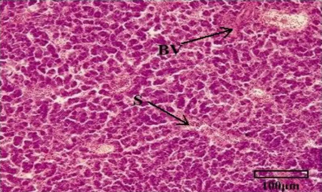 图4肝组织出现细胞排列松散,细胞核染色加深