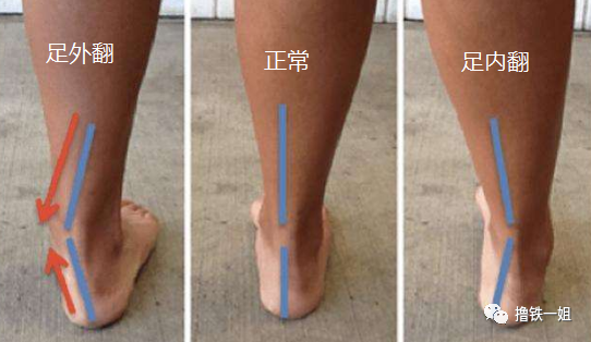 同款脚踝郭碧婷一张神颜毁在金刚小腿上杨幂的重度x型腿却被吹成美腿