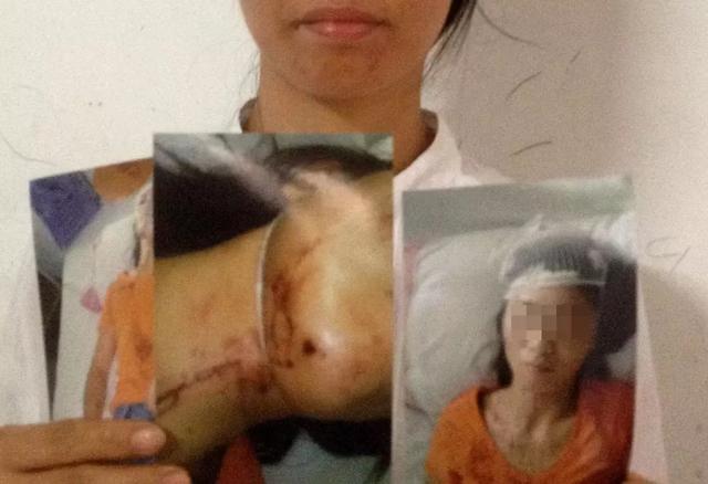 结婚16年,婚姻不幸,多次被家暴,拳头之下,"我"该怎么办?