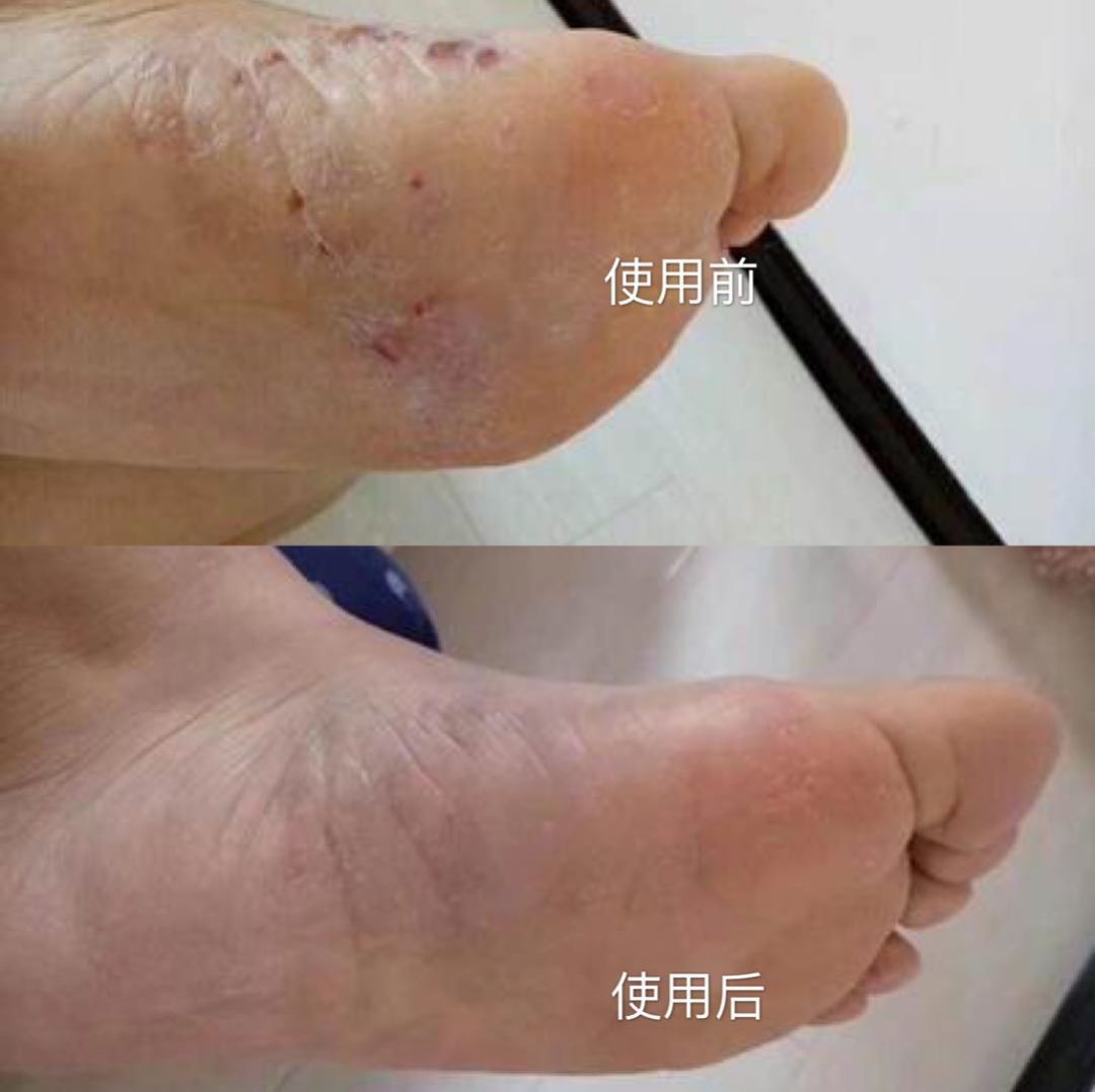 猫咪脚臭是怎么回事（脚臭是怎么回事）-第2张图片-潮百科