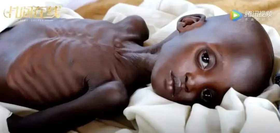 比全球确诊390万更可怕的,是2亿人可能会饿死在2020年.