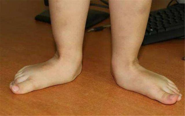 小女孩走路"独树一帜",走出六亲不认步伐,网友:哪吒看多了?