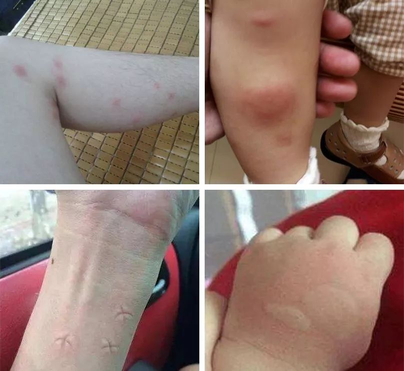 宝格丽出驱蚊手环了百元价位美到哭蚊子躲我5米远