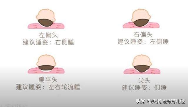 男孩要圆,女孩要扁,让宝宝睡出好头型,你做对了吗