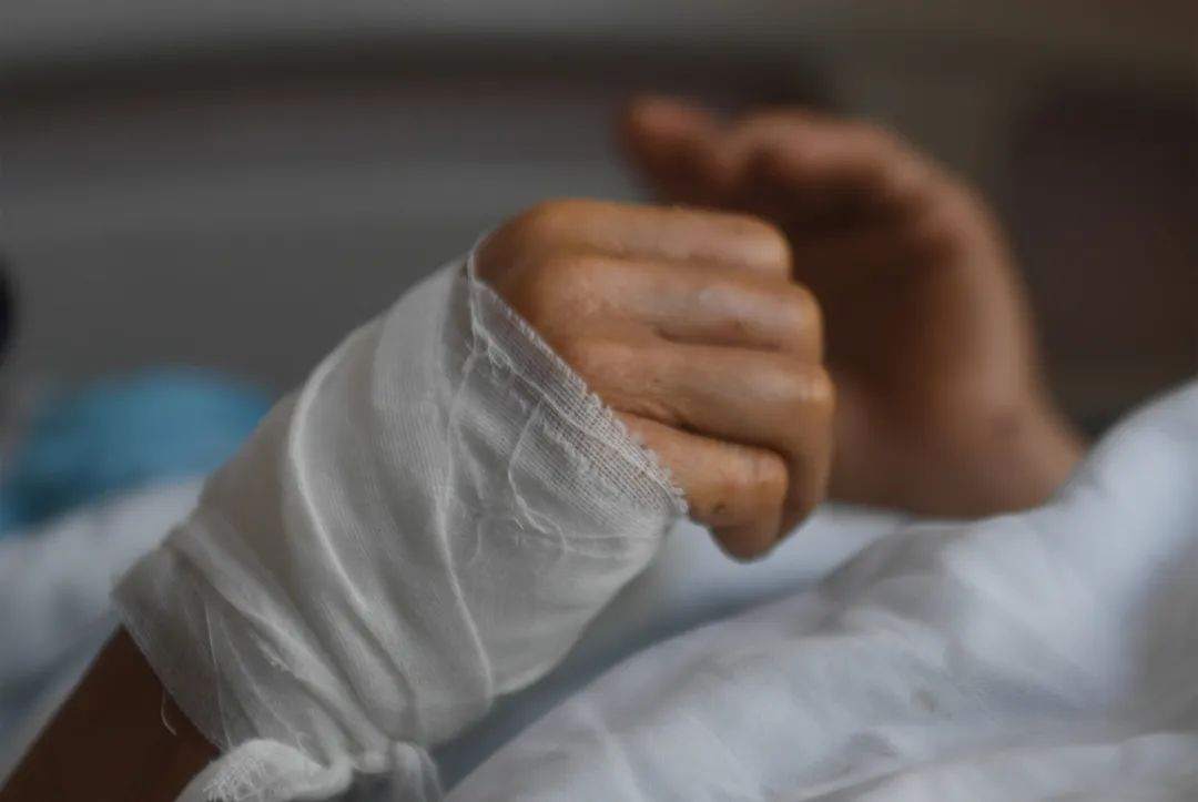 6月14日,一名受伤患者在医院接受治疗.中新社记者 王刚 摄