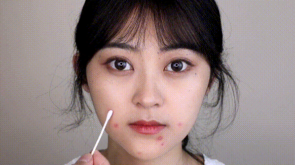 祛痘精华针对痘痘有效果吗