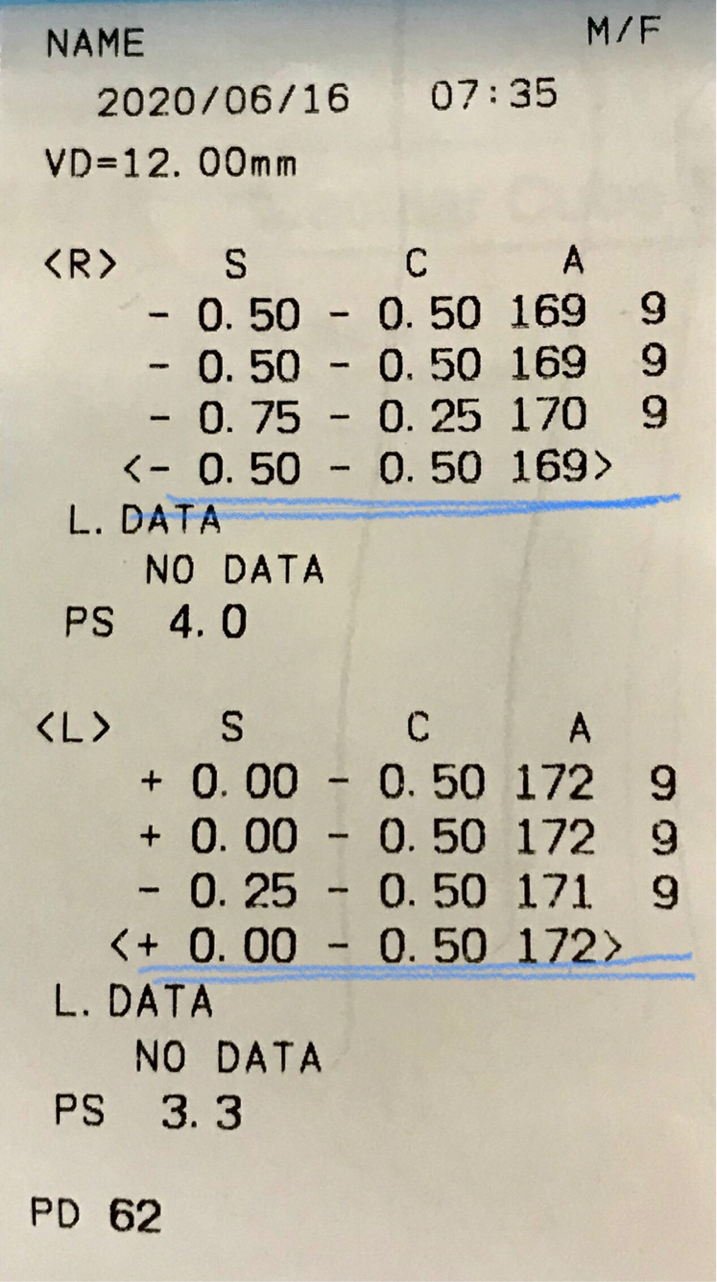 如何判断孩子视力好不好?孩子近视弱视该如何检查和治疗?