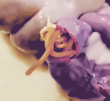 蛔虫|寄生虫_新浪新闻