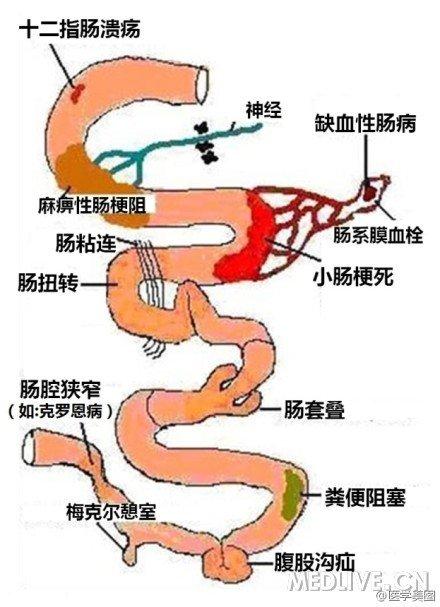大肠小肠如何连接图片