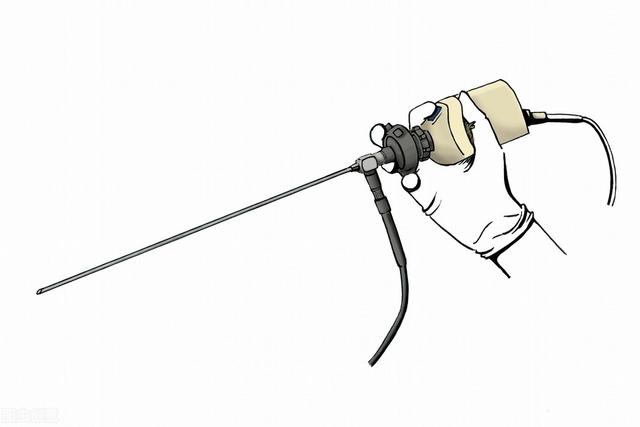 神经内镜手术技术