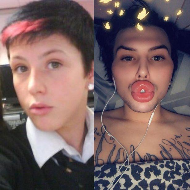 英国最厚嘴唇模特称粉丝为钱猪礼物收到手软月入4万