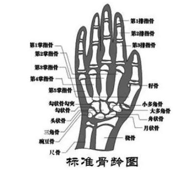 另一个就是生物年龄——骨龄,需要医生利用x线片观察手掌指骨,腕骨及