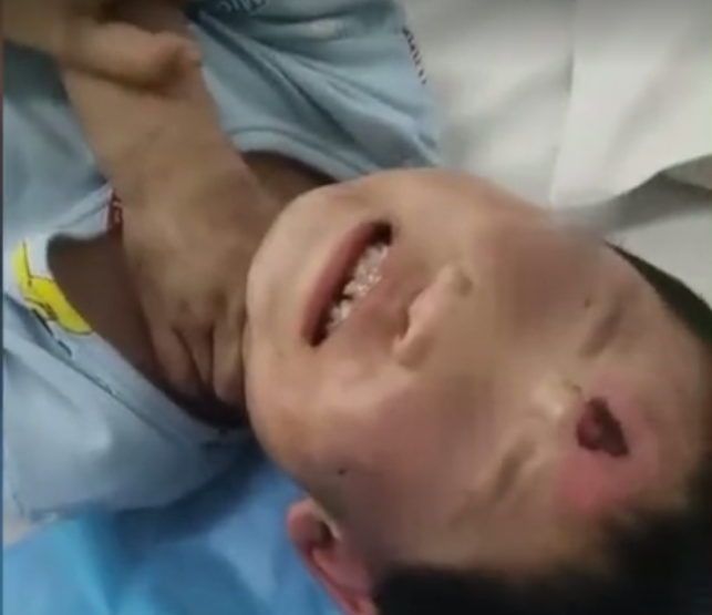 6月1人凡凡的舅舅告诉新京报记者，孩子已经醒了，还需后续治疗。视频截图