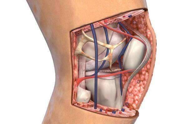 膝关节水肿疼痛,生姜用处大,关节积液,滑膜炎消失了
