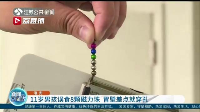 11岁男孩误食8颗磁力珠 胃壁差点就穿孔