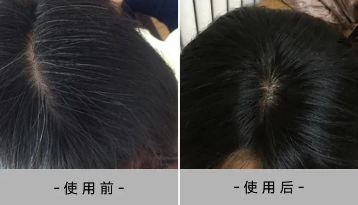 头发白了不用染 老一辈的黑发秘笈帮你养回来 手机新浪网