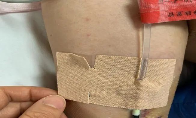 高举|3m|导管_新浪新闻