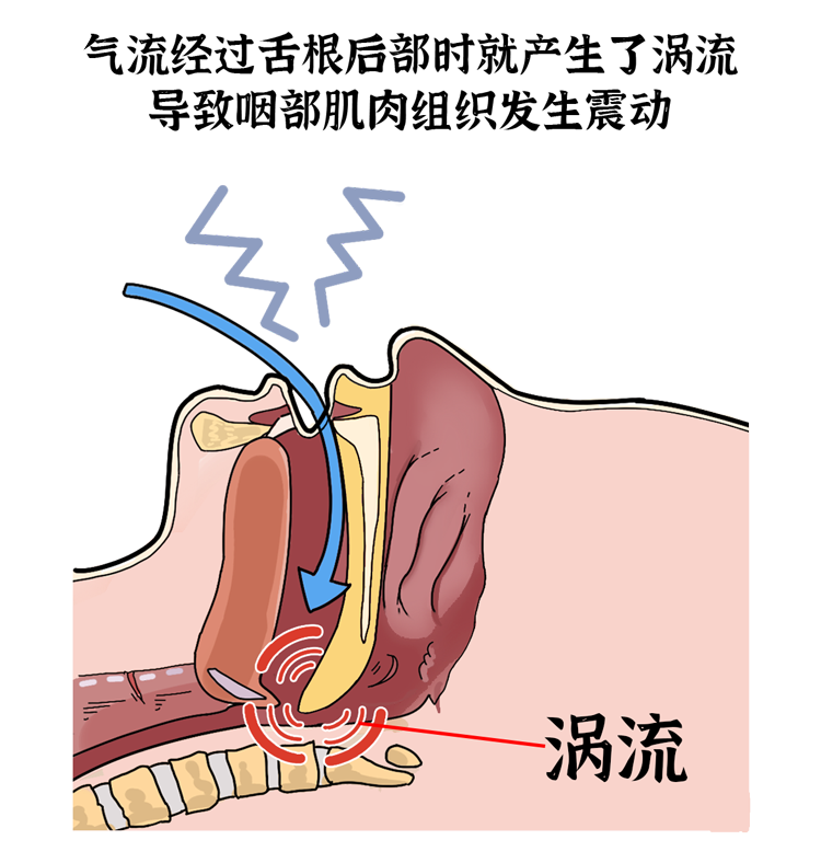 打鼾|呼吸暂停|综合征_新浪新闻