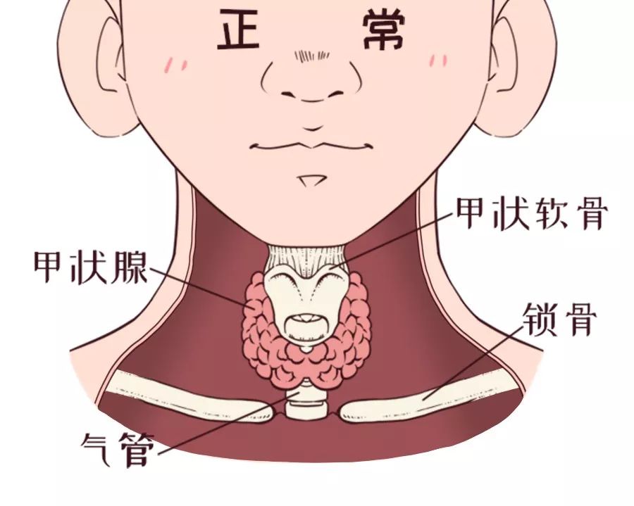 (好发女性)