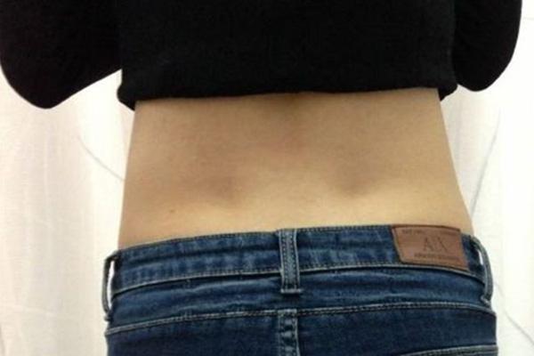 女性后腰两个凹点是什么为何只有少数人有
